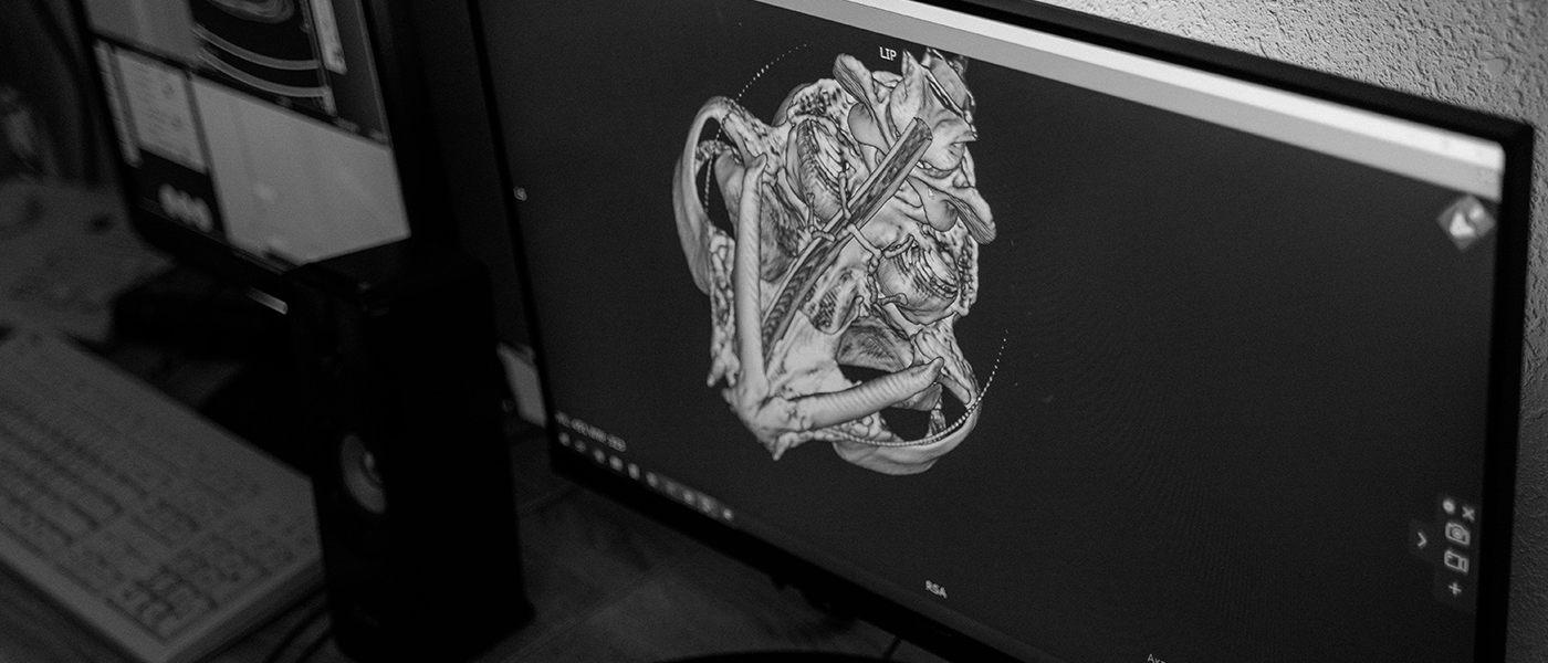 Coimputer screen with a graphic representation of an organ