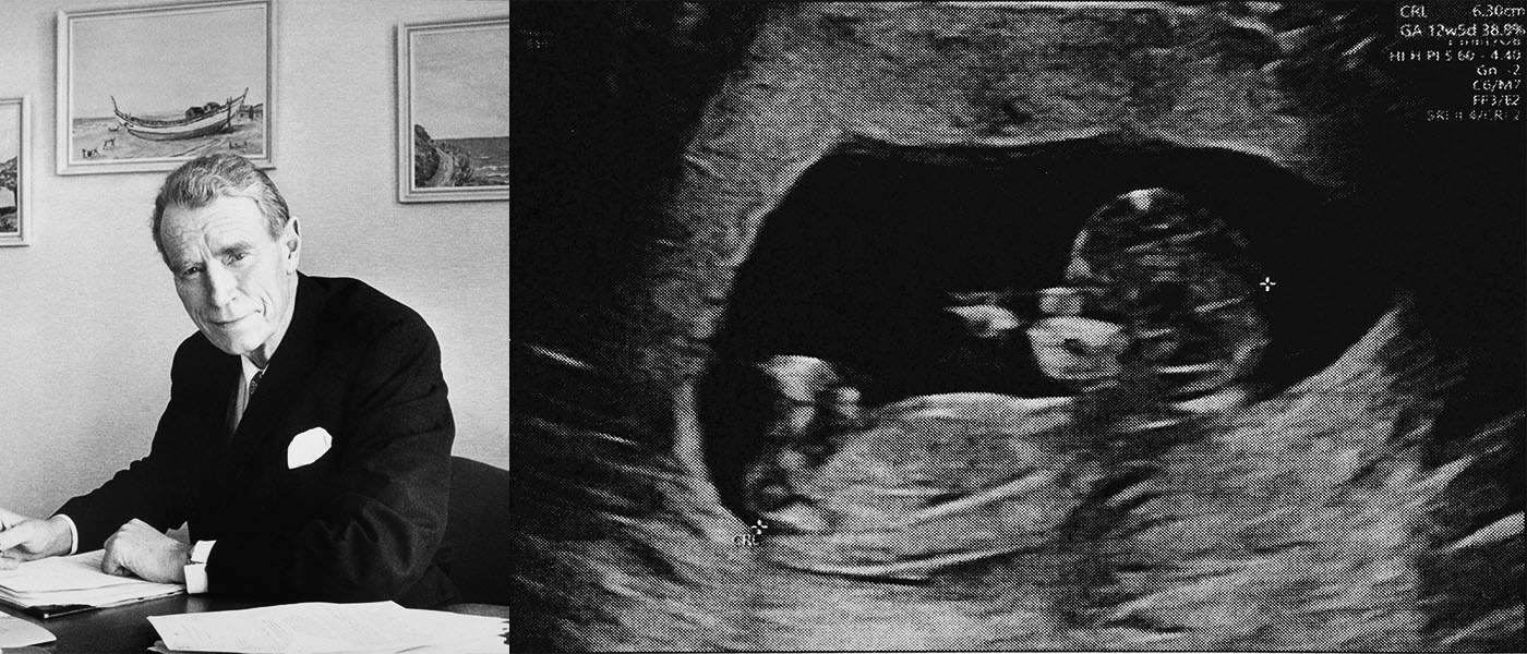 Professor Ian Donald published the world's first ultrasound image of a foetus in 1958, revolutionising prenatal care.