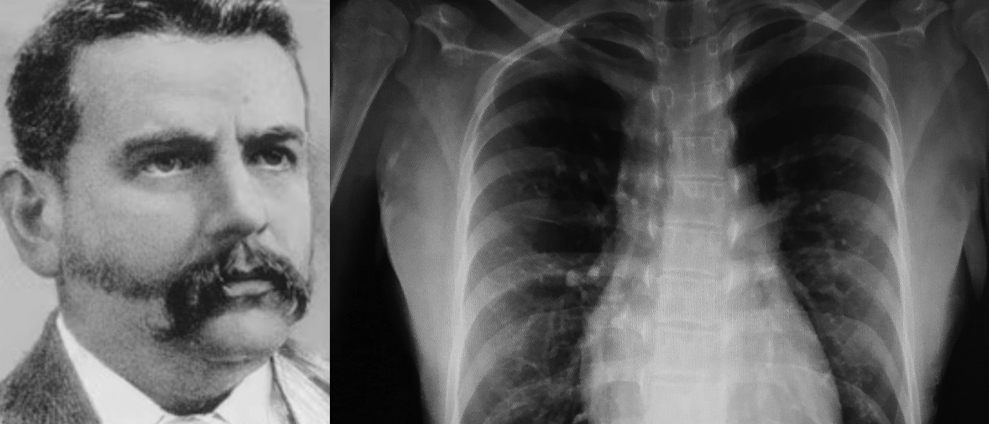 in 1896, Glasgow graduate John Macintyre established the world's first hospital x-ray department, ushering in a new era of medical diagnosis