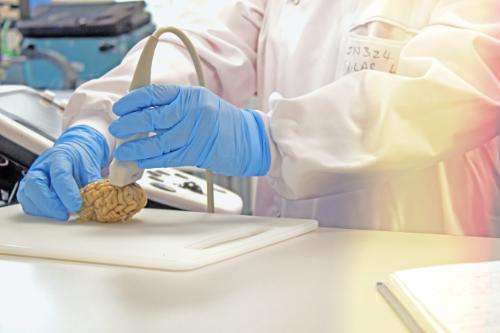 A brain is scanned with ultrasound imaging equipment