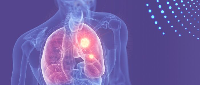 Graphic showing lungs inside a torso
