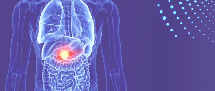 Graphic showing pancreas inside a torso
