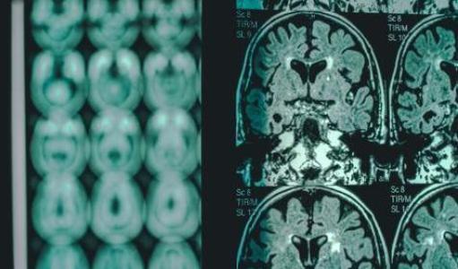 A screen shows multiple brain scan images