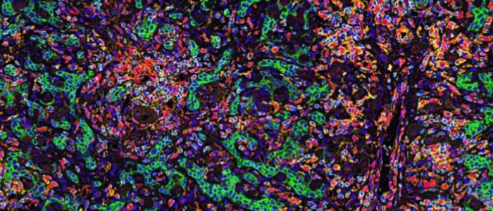CODEX analysis of liver tissue